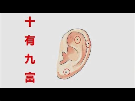 耳痣圖|耳朵痣相：你的潛在好運氣